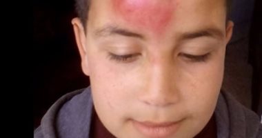  تلميذ يتعرض للضرب على يد زميله بإحدى مدارس كفر الشيخ 