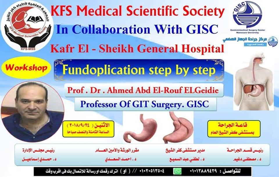  اليوم: ورشة عمل لإصلاح ارتجاع المرئ بالمنظار الجراحي لأول مره فى كفر الشيخ بالمستشفى العام